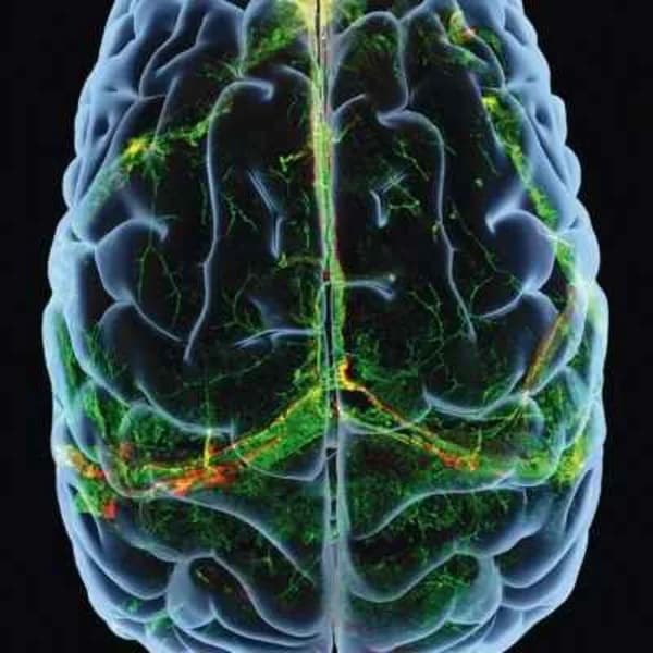 Cover art for NPP BrainPod